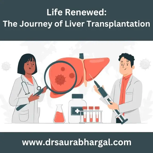 liver transplant specialist in indore