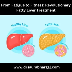 fatty liver treatment in indore