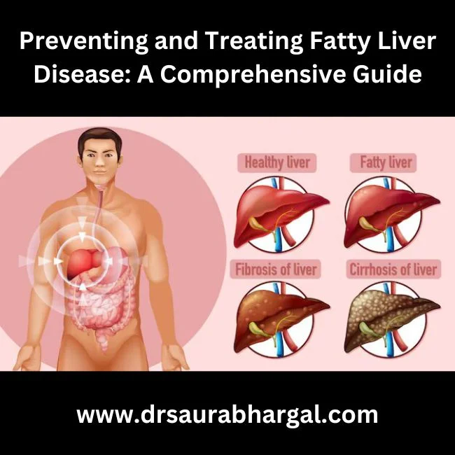 doctor for fatty liver disease in Indore