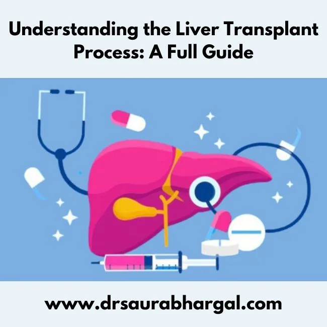Understanding the Liver Transplant Process A Full Guide