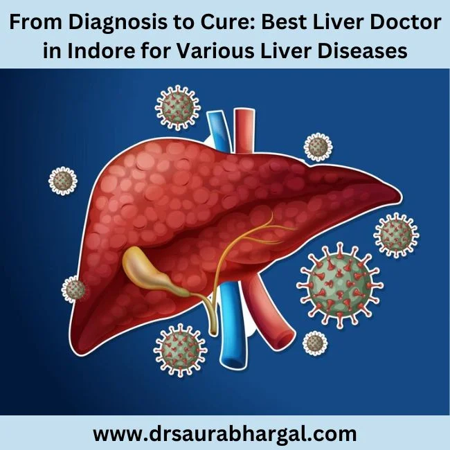 Best Liver Doctor in Indore