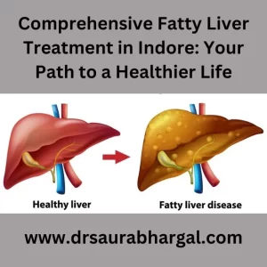 fatty liver treatment in Indore