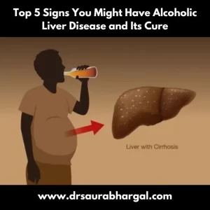 Alcoholic Liver Disease