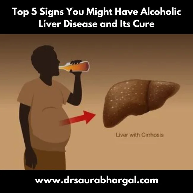 Alcoholic Liver Disease