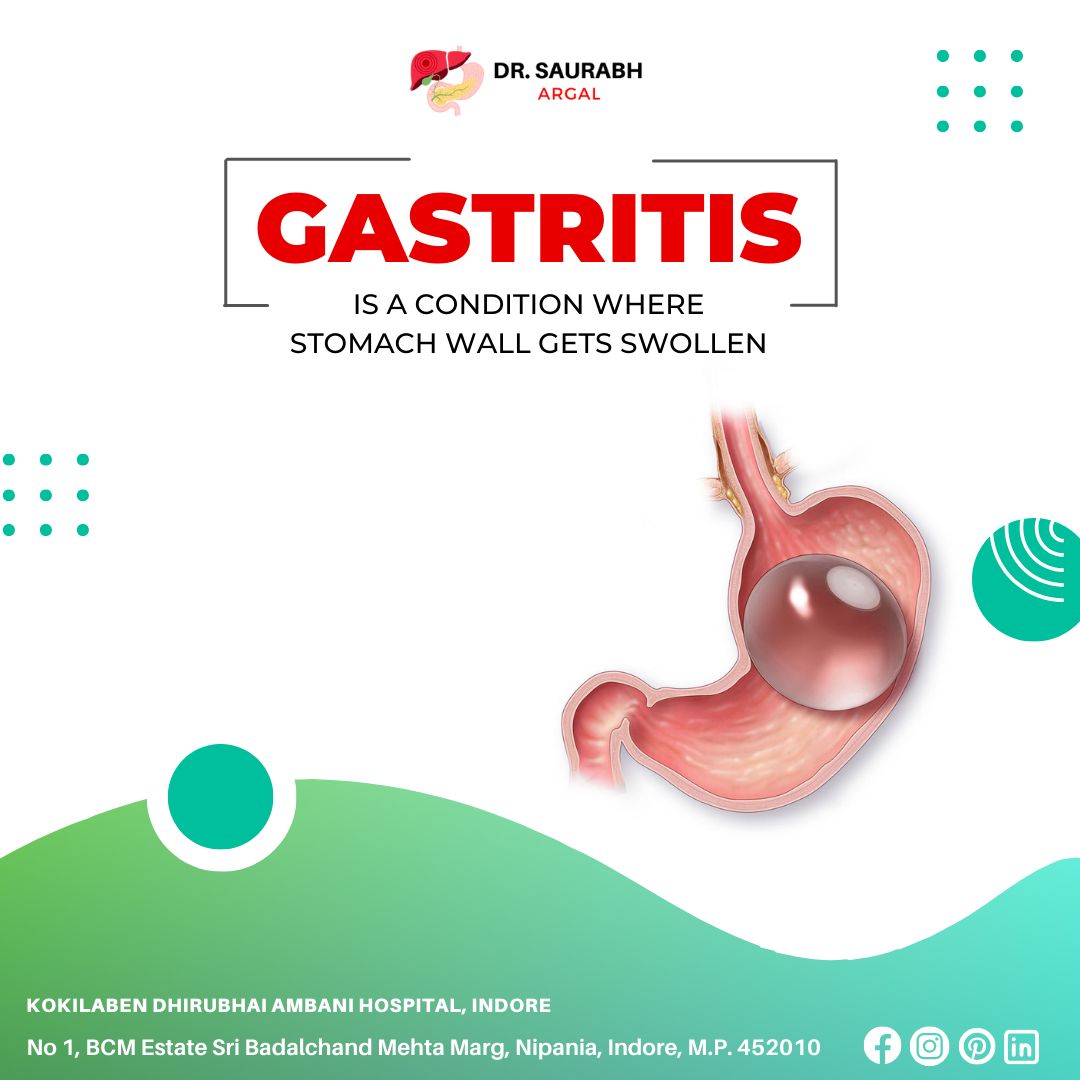 Best Gastroenterologist near Jail Road, Indore