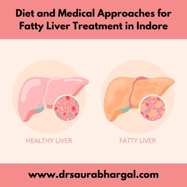 Fatty Liver Treatment in Indore