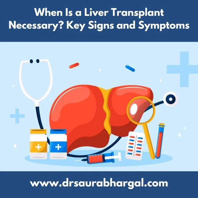 liver transplant in Indore